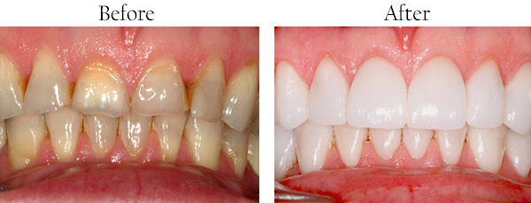 Dental Images 60062
